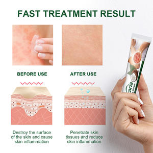 Crème anti-démangeaisons pour les mains et les pieds - Baume réparateur nourrissant et éliminant les peaux mortes - Product Image 3