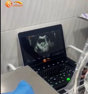 Mesin <span class=keywords><strong>Ultrasound</strong></span> PW kinerja tinggi SUN-800C hemat biaya untuk klinik spesialis Rumah Sakit Umum - Product Image 3