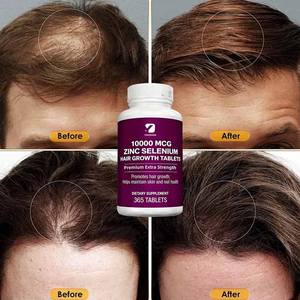 10000mcg Zinc Selenio Tabletas <span class=keywords><strong>para</strong></span> <span class=keywords><strong>el</strong></span> crecimiento del cabello Fábrica Suplemento <span class=keywords><strong>para</strong></span> la salud del cabello y la piel 365 Tabletas nutricionales - Product Image 4
