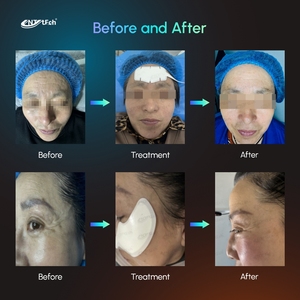 Máquina de Lifting <span class=keywords><strong>Facial</strong></span> Ems Rf a Precio de Fábrica, Máquina Profesional de Masaje Eléctrico Ems para Esculpir Músculos Faciales con 7 Almohadillas - Product Image 6