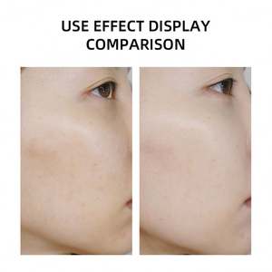 Soins du visage, collagène, taches brunes, hydratant, anti-âge, rides, peau éclatante, crème pour le visage à la truffe noire 24K pour femmes - Product Image 3