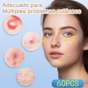 60 piezas lindo impreso <span class=keywords><strong>Starface</strong></span> acné tratamiento pegatinas hidrocoloide acné espinillas parches caja con espejo - Product Image 4