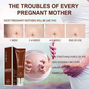 Crème gel <span class=keywords><strong>pommade</strong></span> réparatrice <span class=keywords><strong>de</strong></span> cicatrices et d'acné à base <span class=keywords><strong>de</strong></span> plantes biologiques à étiquette privée, TCM profond, réparation des vergetures - Product Image 3