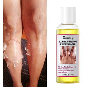 Minyak pengelupas ekstra kuat perawatan kulit wajah pemutih Stretch Patch tanda bekas luka Serum perbaikan penghilang noda hitam produk kecantikan - Product Image 2