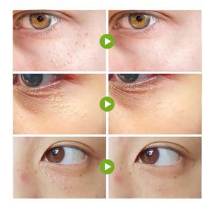 Offre Spéciale extrayant des ingrédients botaniques raffermissent la peau autour des particules de graisse de la vitamine E d'yeux enlevant la crème - Product Image 2