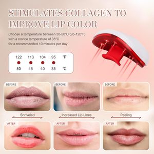 Appareil de soin des lèvres naturel et biologique pour un effet repulpant durable, sans injection, pour des lèvres brillantes et soignées - Product Image 4