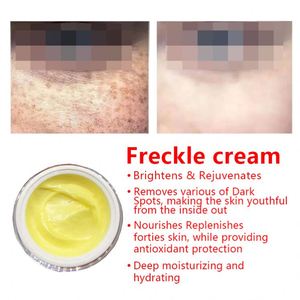 Made in China Powerful Whitening <strong>Freckle</strong> <strong>Cream</strong> Herbal Plant Face <strong>Cream</strong> <strong>Remove</strong> <strong>Freckles</strong> and Dark Spots Skin Whitening <strong>Cream</strong> - Product Image 2