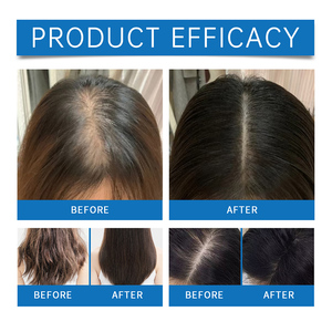 Fábrica Private Label Natural Scalp Care Scalp Cooling <span class=keywords><strong>Hair</strong></span> Ampola Melhorar o crescimento do cabelo Soro Fast <span class=keywords><strong>Hair</strong></span> Growth Oil