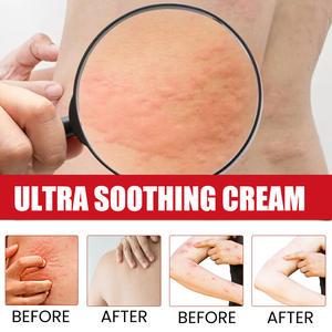 Crema Ximonth al por Mayor para Aliviar Picaduras de <span class=keywords><strong>Mosquitos</strong></span>, Erupciones Cutáneas, Rojeces y Picazón, Crema Ultra Suavizante para el Cuidado de la Piel - Product Image 4