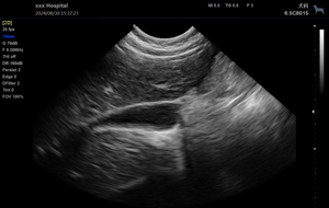 Dierenartsen Ecografie Apparatuur Hot Sales Kleuren Doppler Echografie Systeem Diagnostische Echografie voor Ziekenhuis Kliniek - Product Image 4