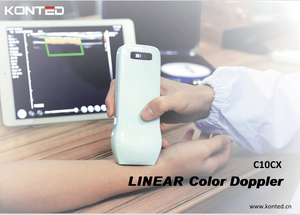 Escáner de ultrasonido inalámbrico <span class=keywords><strong>Vscan</strong></span> Porket de sonda de ultrasonido C10CX de Konted MDR - Product Image 6