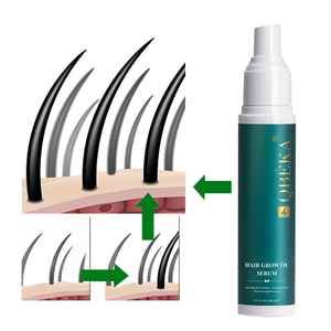 Sérum capillaire pour le cuir chevelu en marque privée, traitement fortifiant et épaississant pour les cheveux, OEM ODM - Product Image 2