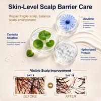 Shampooing et après-shampooing sans sulfate pour traitement antipelliculaire, anti-démangeaisons, contrôle du sébum, produits capillaires au sulfure de sélénium