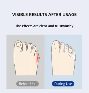 Silicone Gel Foot Fingers Two Hole Toe Separator Thumb Valgus <strong>Protector</strong> <strong>Bunion</strong> Adjuster Valgus Guard Feet Care - Product Image 5