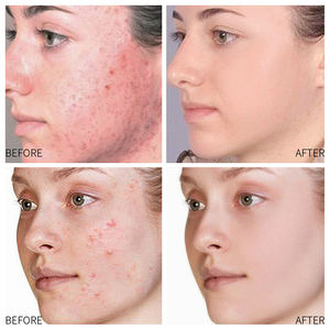 OEM ODM Limpieza profunda Barro Belleza Mascarilla Cuidado DE LA PIEL Orgánica Cúrcuma Arcilla Mascarilla para piel seca - Product Image 5