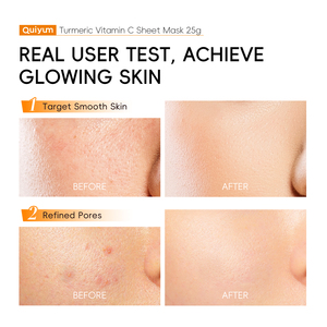 Masque facial éclaircissant au curcuma et à la vitamine C, format voyage 25 ml, hydratant en profondeur, blanchissant et hydratant, masque en tissu pour le visage, vente en gros - Product Image 6