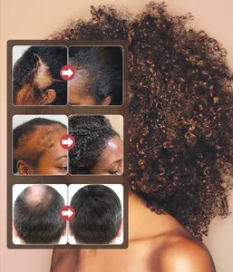 Eigenmarke Kopfhaut-Haarpflegebehandlung Batanaöl bio-Shampoo fördert Haaraufbau Honduras Batanaöl-Butter für Haare