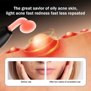 Dispositivo De Belleza Facial Inalámbrico 7 en 1 De Alta Frecuencia Para Rejuvenecimiento De La Piel Recargable y Portátil - Product Image 6