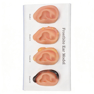 Maniquí DARHMMY para Demostrar las Etapas Progresivas de Congelación de las Orejas, de Leve a Severa, para Enseñanza Médica - Product Image 3