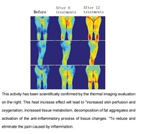 Appareil de massage corporel amincissant à rouleaux internes pour drainage lymphatique et remodelage corporel