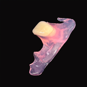 Protesi dentale resistente a buon mercato prezzo flessibile rimovibile protesi rosa Valplast Base ottima vestibilità - Product Image 3