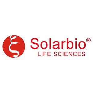 Kit di Estrazione del <span class=keywords><strong>DNA</strong></span> Genomico di Funghi Solarbio D2300 di Alta Qualità per la Ricerca Scientifica - Product Image 3