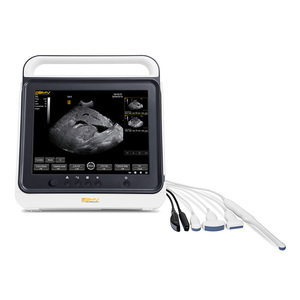 Scanner à ultrasons numérique léger BMV PT50A, équipement vétérinaire portable et léger avec écran tactile - Product Image 5