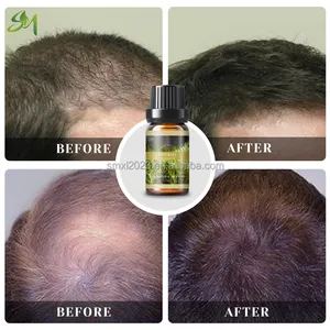 Aceite de ricino orgánico del crecimiento del pelo del extracto del tratamiento del cabello de la reparación del fortalecimiento de la etiqueta privada del OEM con aceite de Romero