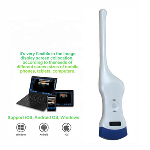 B26D Onetech Imagerie par ultrasons Scanner de sonde à ultrasons portable Doppler Tableau de courbes intracavitaire Sonde sans fil à ultrasons - Product Image 2
