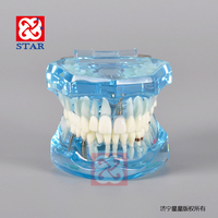 Puente de restauración de dientes extraíbles estándar, modelo Dental, enfermedad de implante, modelo Typodont para dentista que estudia ciencias médicas