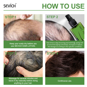 Lozione per la Crescita dei Capelli 120ML Molto Richiesta alla Fiera di Canton, Olio per la Crescita dei Capelli Tailandese per Uomini e Donne, Spray per la Crescita della Radice dei Capelli - Product Image 6