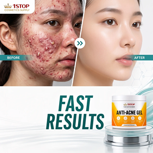 Lancement de la crème pour le visage à l'<span class=keywords><strong>acide</strong></span> <span class=keywords><strong>hyaluronique</strong></span> et aux céramides, crème pour peaux sujettes à l'acné, crème éclaircissante pour la peau sans <span class=keywords><strong>effets</strong></span> <span class=keywords><strong>secondaires</strong></span> - Product Image 1