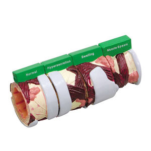 4-delige Brounchus Model Normale Zwelling Hypersecretie Spierspasmen Anatomisch Model - Product Image 2