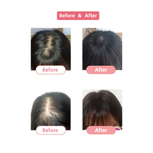 Cosmo ในเกาหลีวิกผมเกาหลีแบบพรีเมี่ยม, วิกผมแท้แบบเกาหลีขนาด8x9วิกผมแท้ยาว8นิ้ว - Product Image 5