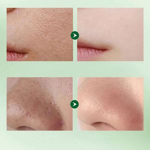 มาส์กหน้าโฟมอะโวคาโดผสมกรด SADOER รุ่นใหม่ล่าสุด ทำความสะอาดล้ำลึก ควบคุมความมัน มาส์กโคลนฟองทำความสะอาด - Product Image 4