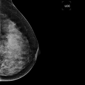 Système de mammographie numérique à rayons X, appareil à rayons X INM-5KW avec tube à rayons X pour mammographie d'origine italienne IAE - Product Image 5