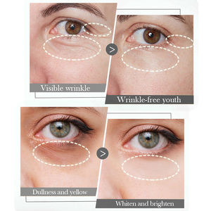 निजी लेबल वीगन आंखों की देखभाल क्रीम मजबूत जेल आंख बैग हटाने क्रीम के तहत आंख बैग हटाने क्रीम के तहत - Product Image 3