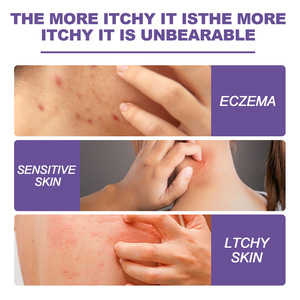 กลากวิโอลาครีมบรรเทาอาการผื่นแดงผื่น<span class=keywords><strong>คัน</strong></span>ผื่น<span class=keywords><strong>คัน</strong></span>ผื่น<span class=keywords><strong>คัน</strong></span>บนใบหน้าและร่างกายทันที24กรัม - Product Image 3