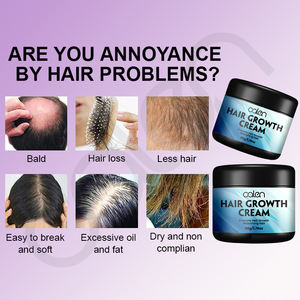 Oalen, venta al por mayor, crema para el crecimiento del cabello, aceite de árbol de té de acción rápida vegano orgánico, nutritivo, refrescante, tratamiento para la pérdida de cabello, muestra gratis - Product Image 4