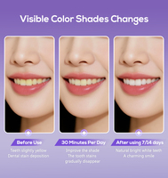 Tiras Blanqueadoras de Dientes Glorysmile V34, 14 Tratamientos, Tecnología Correctora de Color, Blanqueamiento Instantáneo e Indoloro