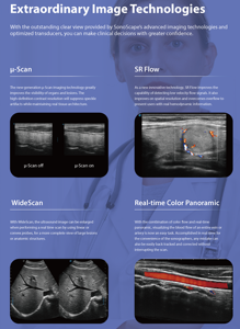 Sonoscape P9 Elite Độ phân giải cao chẩn đoán hình ảnh ai siêu âm DOPPLER màu xe đẩy máy siêu âm cho phòng khám/bệnh viện - Product Image 3