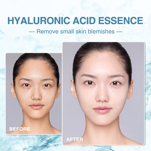 Suero Facial Antienvejecimiento al por Mayor con Escualano, Ácido Hialurónico, Manteca de Karité, <span class=keywords><strong>Aloe</strong></span> Vera y Té Verde para Uso Doméstico - Product Image 6