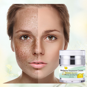 <span class=keywords><strong>Crème</strong></span> Visage Personnalisée au Logo, à l'Extrait Végétal de Niacinamide, Éclaircissante Anti-Taches, Soin du Visage à la Vitamine E et à l'Huile de Jojoba, pour Tous Types de Peau - Product Image 1