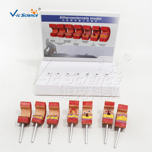 Modelo de <span class=keywords><strong>Arteriosclerosis</strong></span> con Tarjeta de Instrucciones, Modelo Anatómico de Lesiones Vasculares para <span class=keywords><strong>la</strong></span> Educación sobre <span class=keywords><strong>la</strong></span> Salud Cardiovascular - Product Image 6