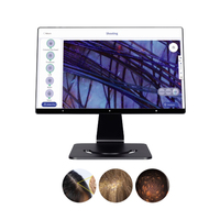 Máquina de Análisis Capilar Litian AI con Pantalla Táctil y Ampliación de 200x para Detección de Folículos y Uso Comercial/SPA