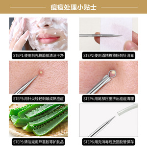 Acne Needle Set Stainless Steel Four Piece For Face Blackhead <b>Remover</b> Tool - Product Image 1