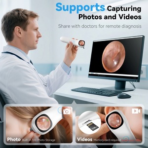 กล้องดิจิตอล4อิน1 1080P HD ช่องจมูก<span class=keywords><strong>ผิว</strong></span>หนังบริเวณปากเครื่องตรวจจับช่องหูแบบชาร์จไฟได้1000mAh - Product Image 3