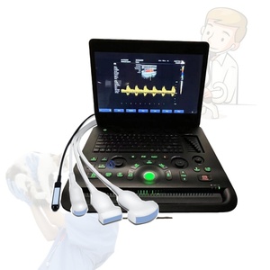 Termurah Ecograph 3D 4D Laptop CW hybrid array probe warna Doppler Ultrasound Harga jantung warna Doppler - Product Image 1