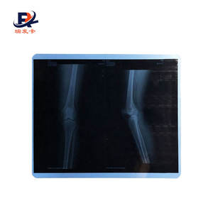 Film radiographique <span class=keywords><strong>dentaire</strong></span> <span class=keywords><strong>panoramique</strong></span> Offre Spéciale - Product Image 6