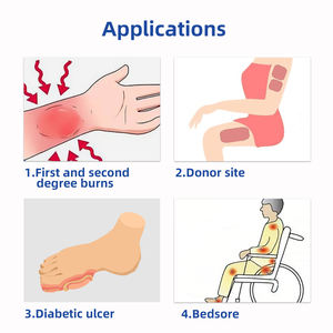 น้ำสลัดอัลจิเนตทำจากเงินเกรดทางการแพทย์ - Product Image 2